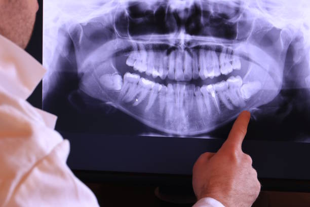Best Emergency Dental Care for Sports Injuries in Shinnston, WV