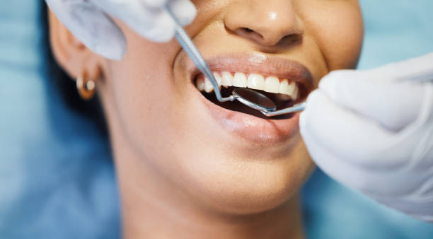 Best Emergency Wisdom Tooth Extraction in Shinnston, WV